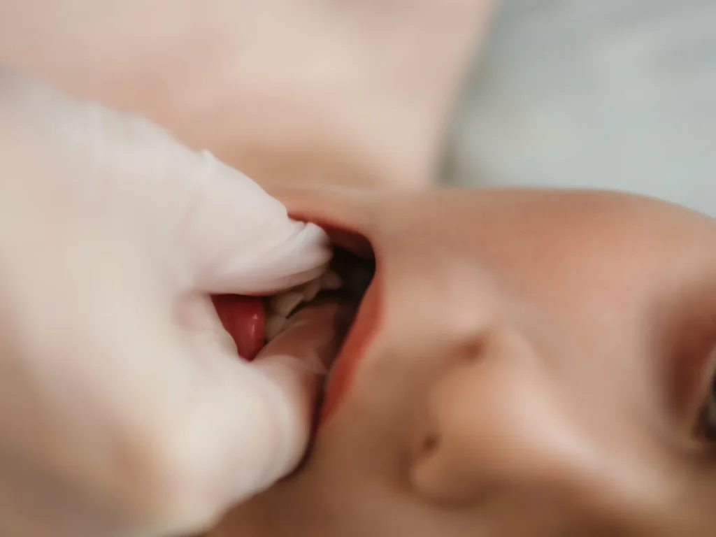 Gloved hand examining an infant’s mouth